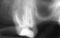 Dentist - Root Canal - Endodontist - Dentist - Root Canal - Endodontist -
