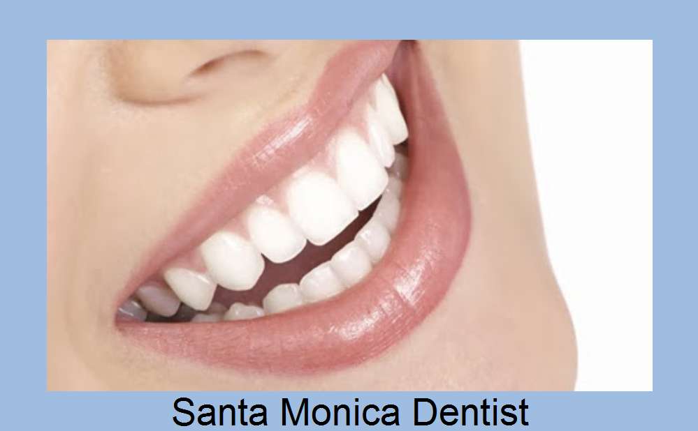 Santa Monica - Beverly Hills - Dental Veneers - 