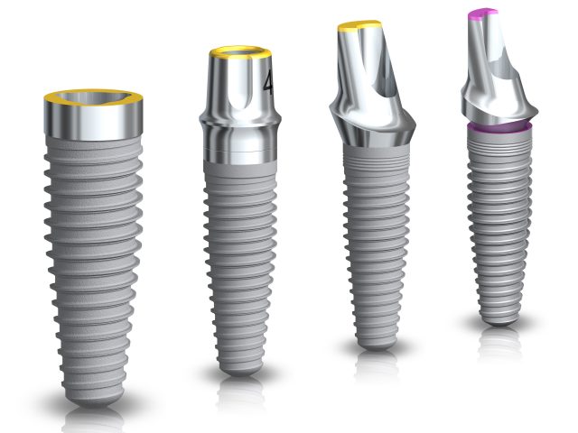Dental Implants Santa Monica
