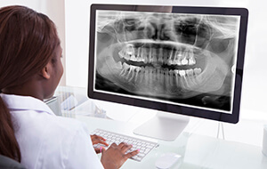 Panoramic dental x-rays on computer